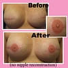 3-D nipple tattoo