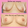 nipple areola tattoo