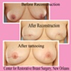 nipple areola tattoo