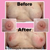 3-D nipple tattoo