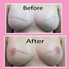 3-D nipple tattoo
