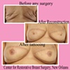 nipple areola tattoo