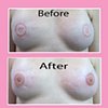 3-D nipple tattoos