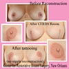 3-D nipple tattoo