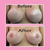 3-D nipple tattoos