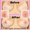 3-D nipple tattoo