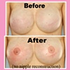 3-D nipple tattoo