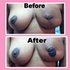 nipple tattoo  (partial)