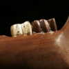 Food #1 (detail)